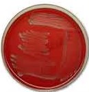 Gamma hemolysis