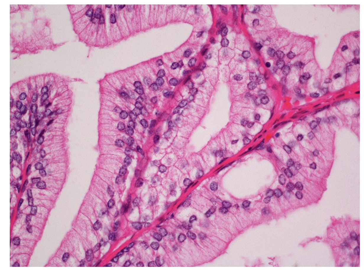 <p>koks čia dažymo būdas?</p>