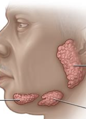 <p>label the salivary glands</p>