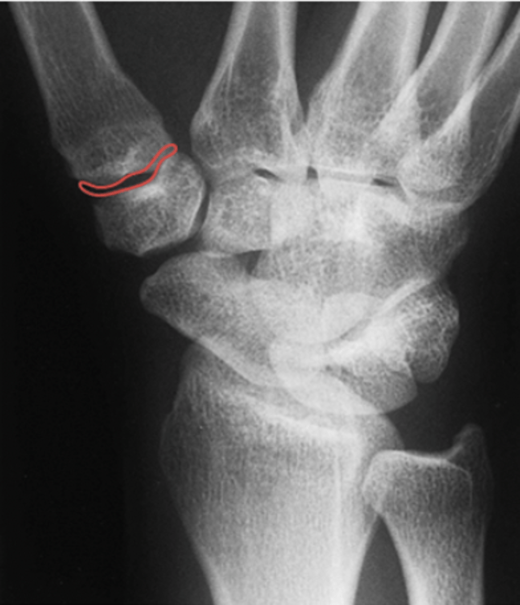 <p>What structure is highlighted?</p>