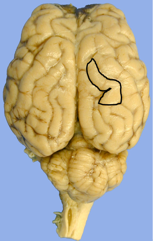 <p>gyrus</p>