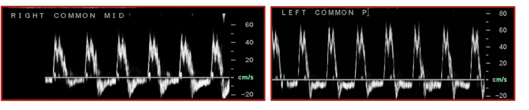 <p>What does this waveform suggest </p>