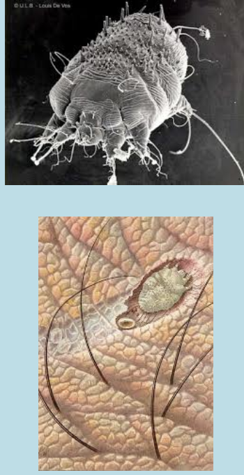 <ul><li><p>Microscopic Sarcoptic mange – burrowing mites cause sarcoptic mange, also known as scabies.</p></li><li><p>These mites will burrow through the skin causing intense itching and irritation.</p></li><li><p>The scratching that results from mange is what causes the majority of the animal&apos;s hair to fall out, and crusting.</p></li><li><p>This is a treatable medical condition but is highly contagious for other animals and humans.</p></li><li><p>Sarcoptic mange mites affect mainly dogs of all ages, during any time of the year.</p></li><li><p>It also can affect other animals as well and transmitted to humans (i.e., Rabbit, Guinea pigs ).</p></li></ul>