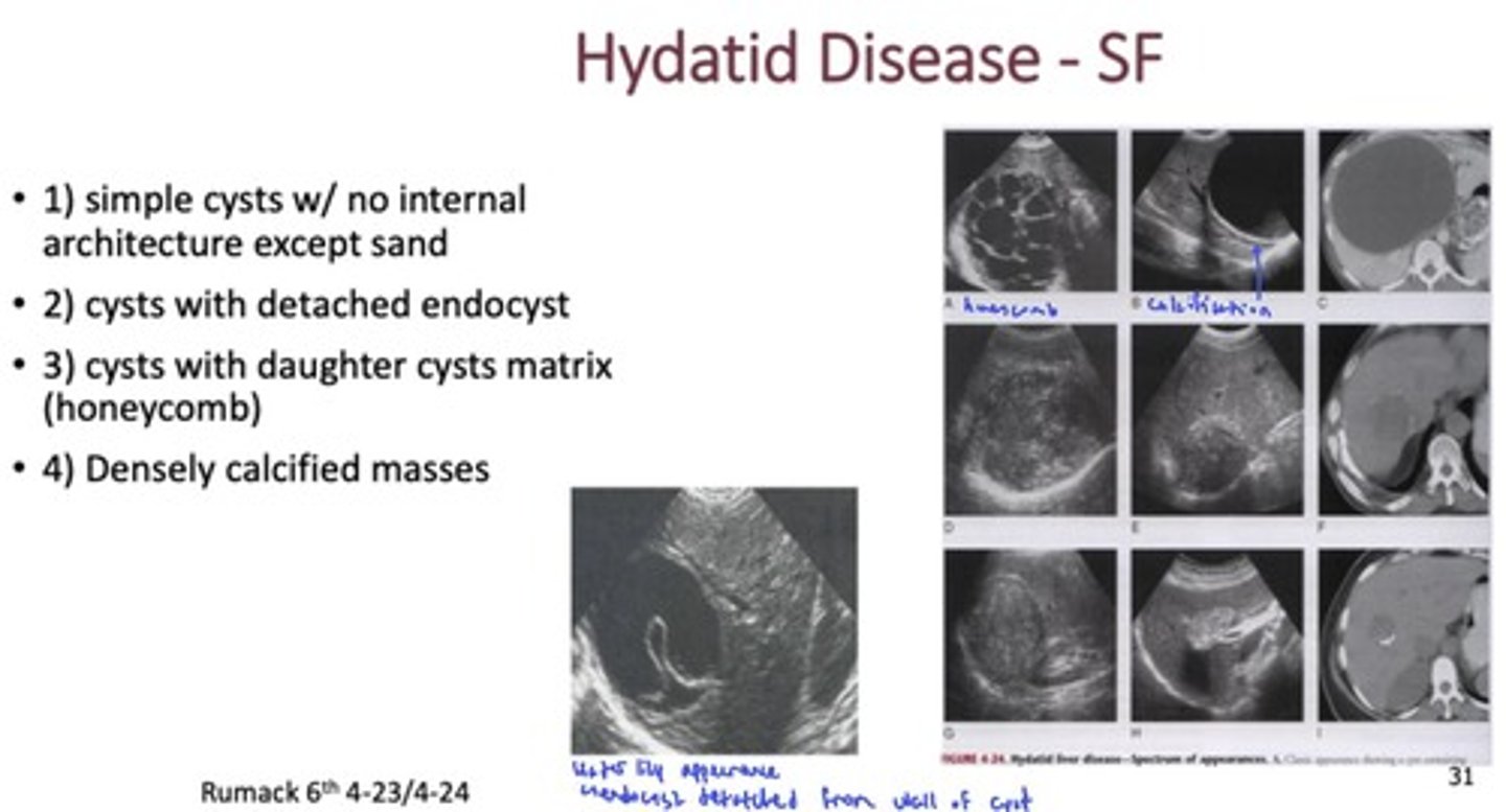 <p>tapeworm that lives in intestines of definitive host (canine animals), creating slow growing cysts in intermediate hosts (humans)</p>