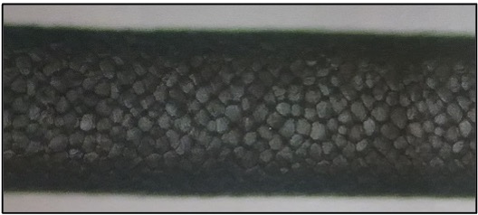 <p>spherical cells occupying entire hair shaft</p>