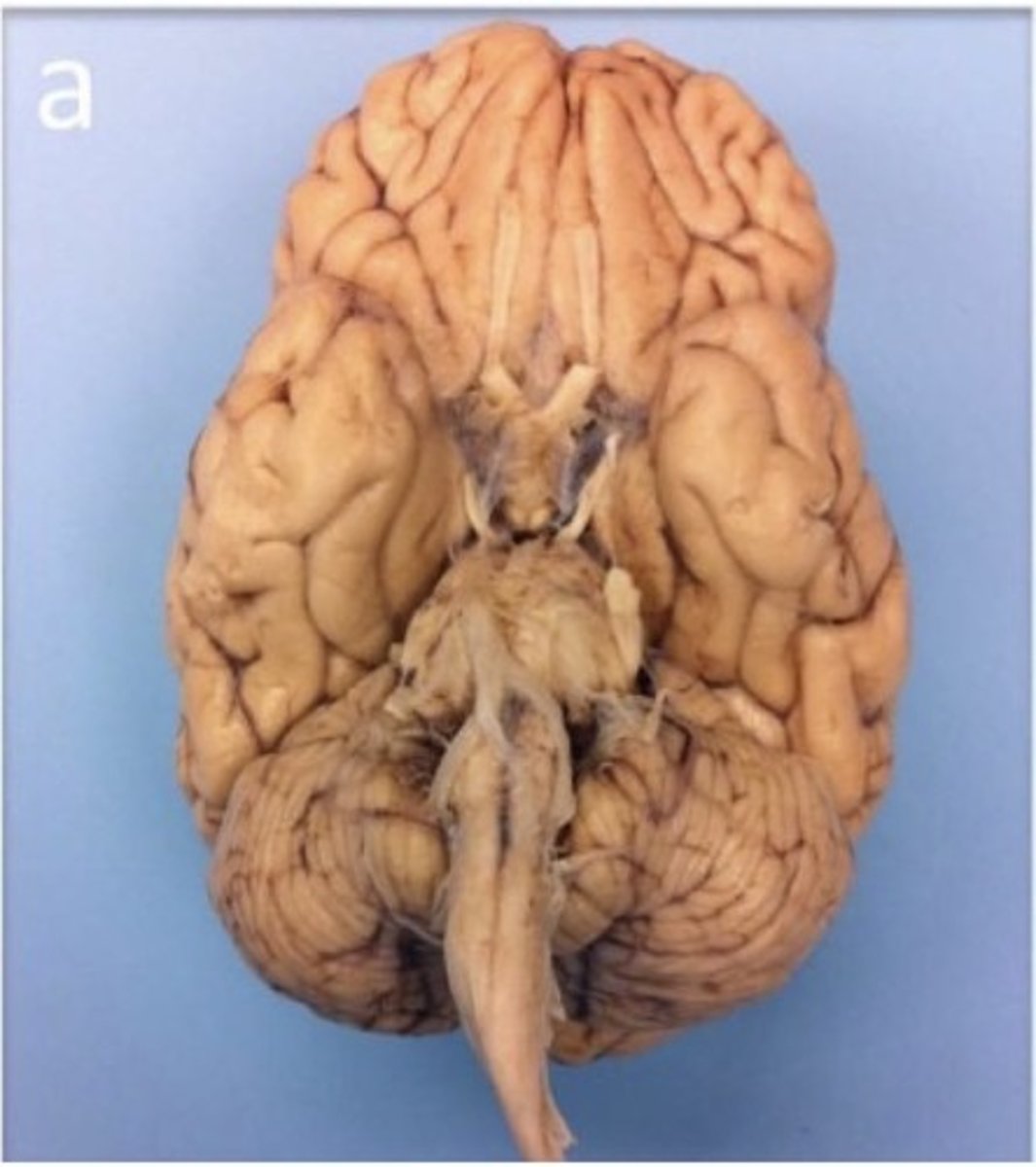 <p>1. Also known as anterior</p><p>2. Refers to the front of an anatomical structure</p>