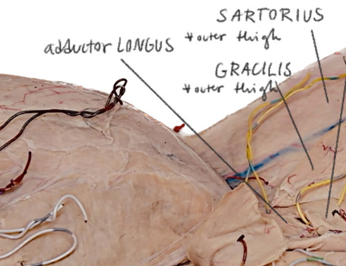 <p>BENEATH GRACILLIS Top</p>