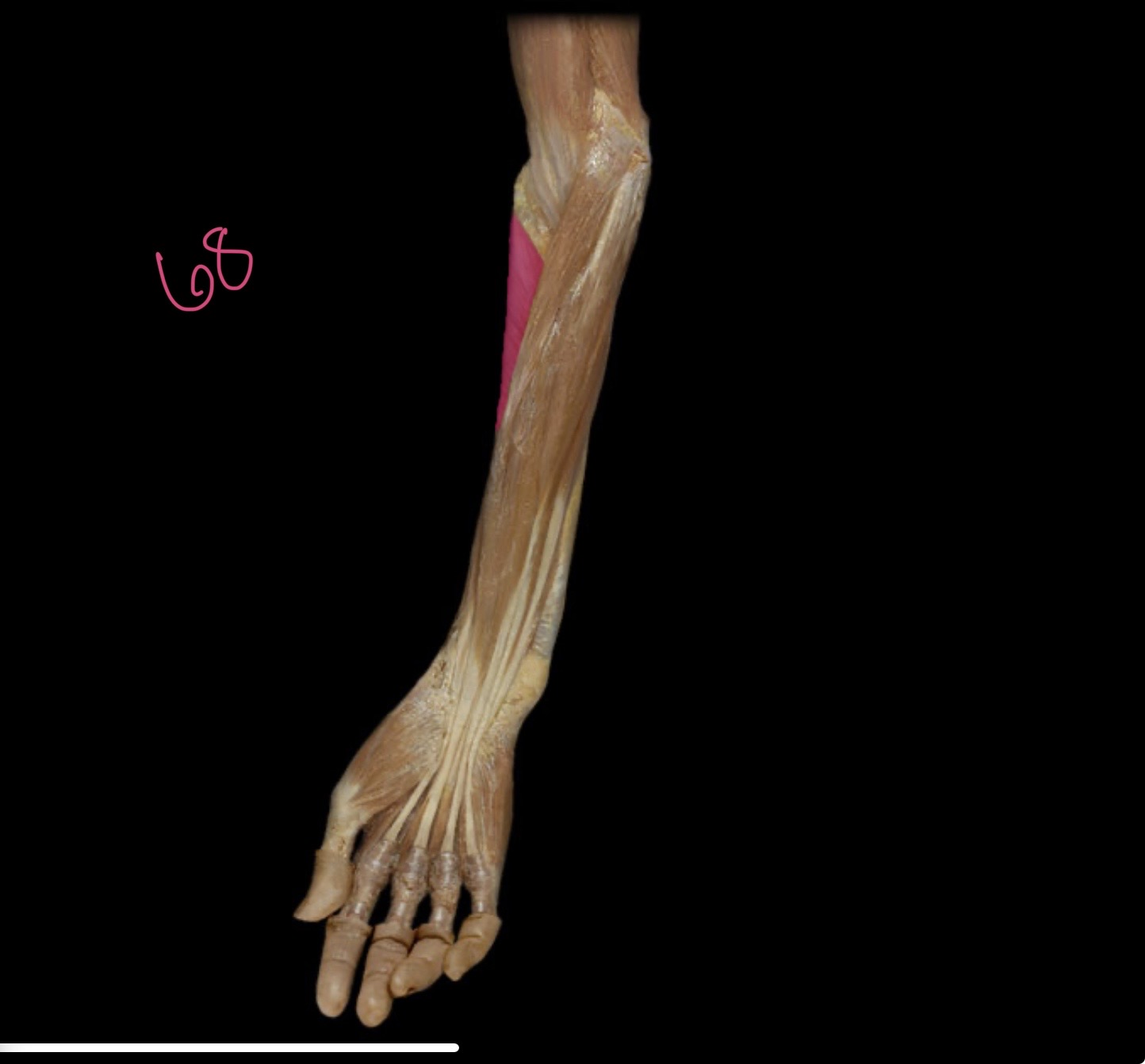 <p>Supinator</p>