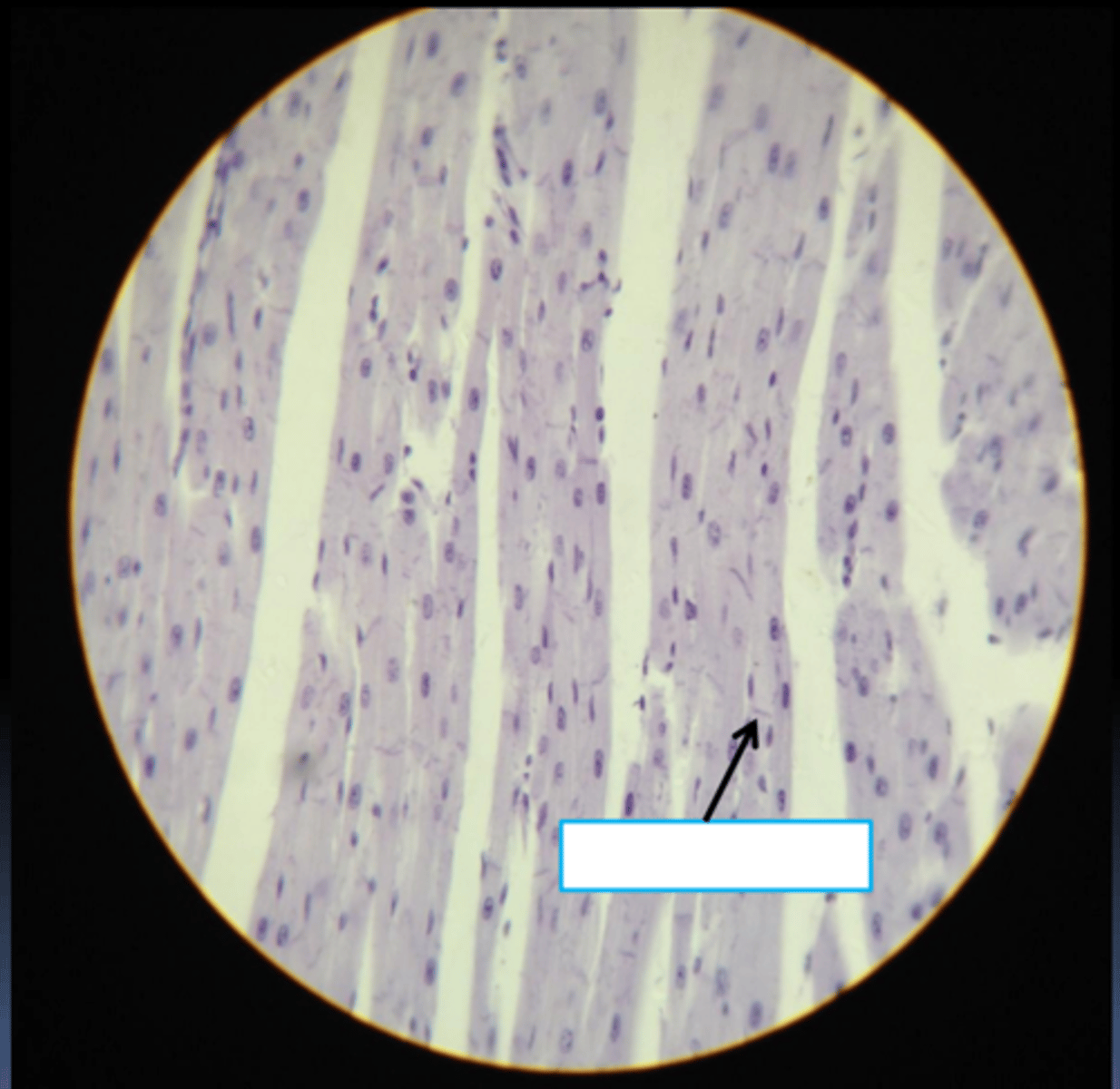 <p>What is this particular subtype?</p>