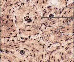 <p>dense, mineralized, hard connective tissue composing the skeleton</p><ul><li><p>two main types: compact (cortical) and spongy (cancellous) bone</p></li></ul><p></p>