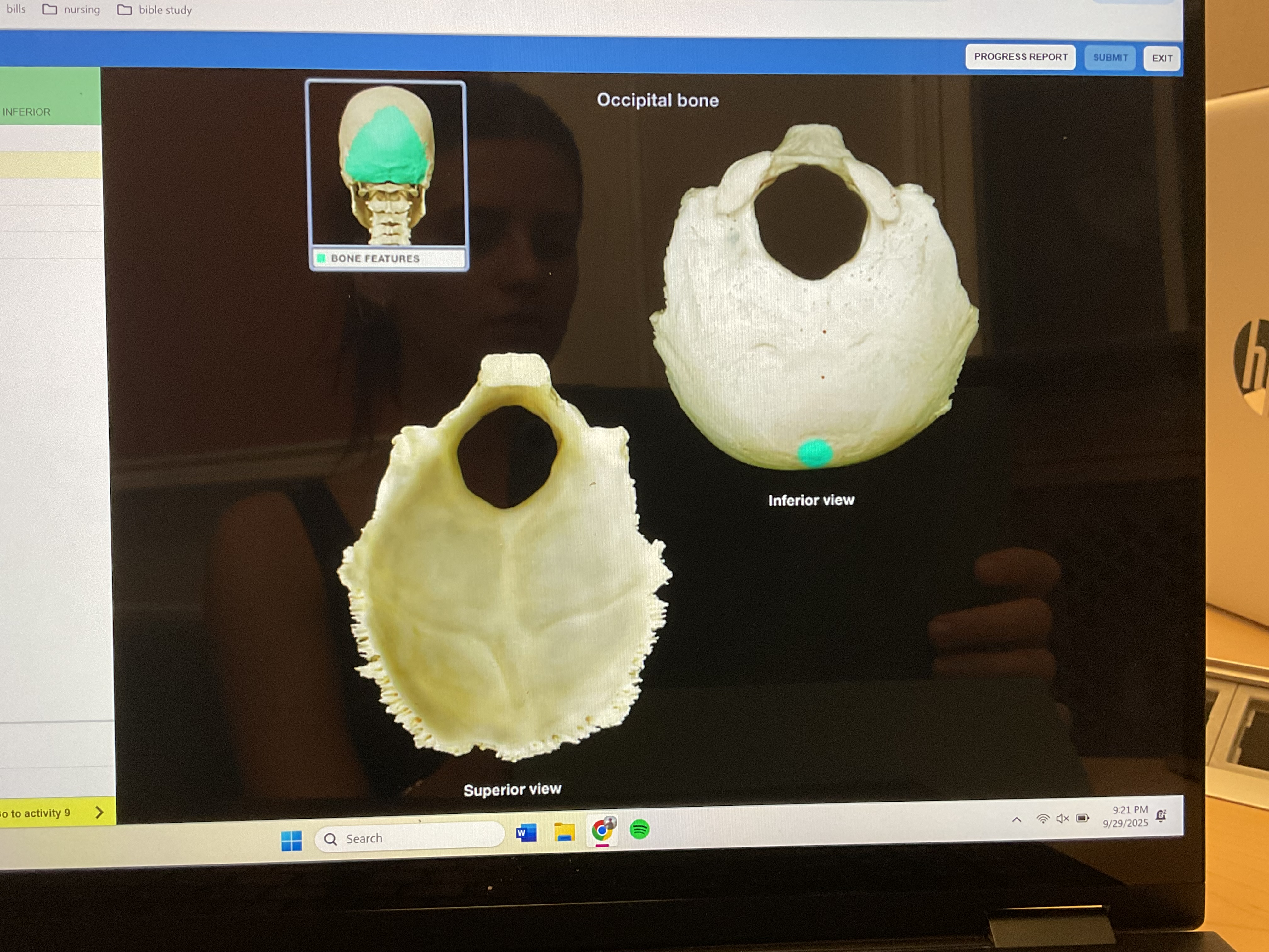 <p>External occipital protuberance</p>