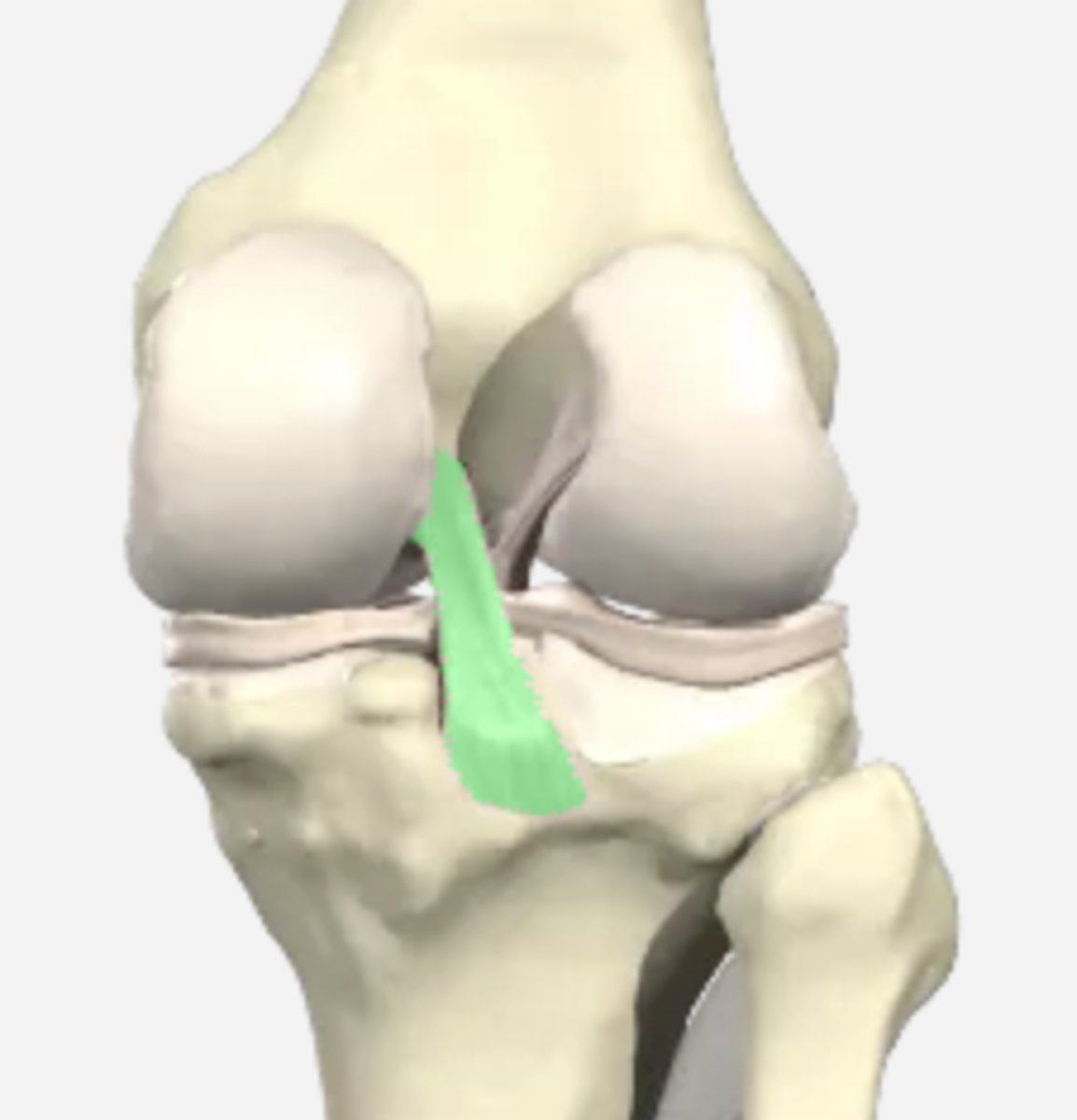 <p>runs from posterior intercondylar area and attaches at anterior lateral surface of medial condyle</p>