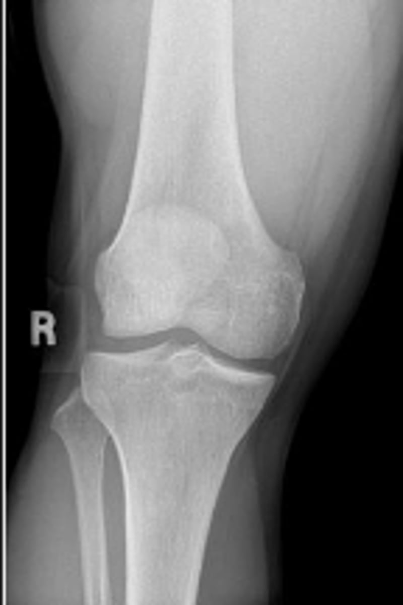 <p>Is the anatomical marker placed in the correct location?</p>