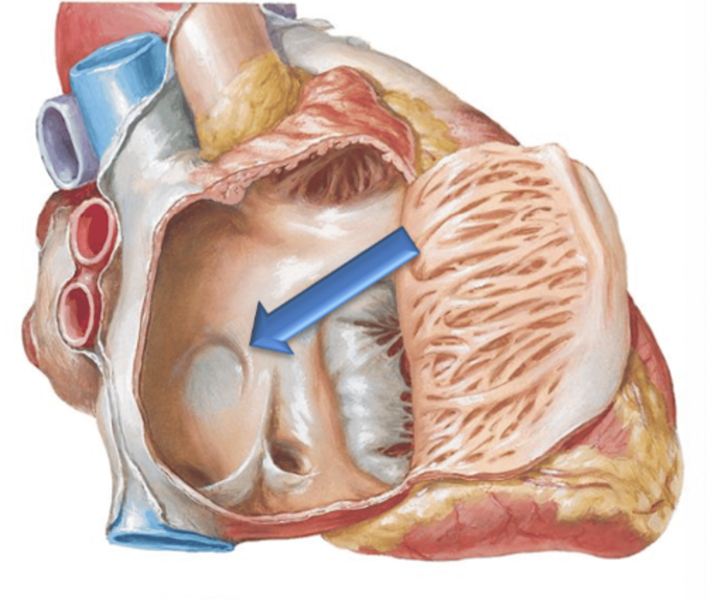 <p>The fossa ovalis is surrounded at its peiphery by a ridge called the ___ ___ ___.</p>
