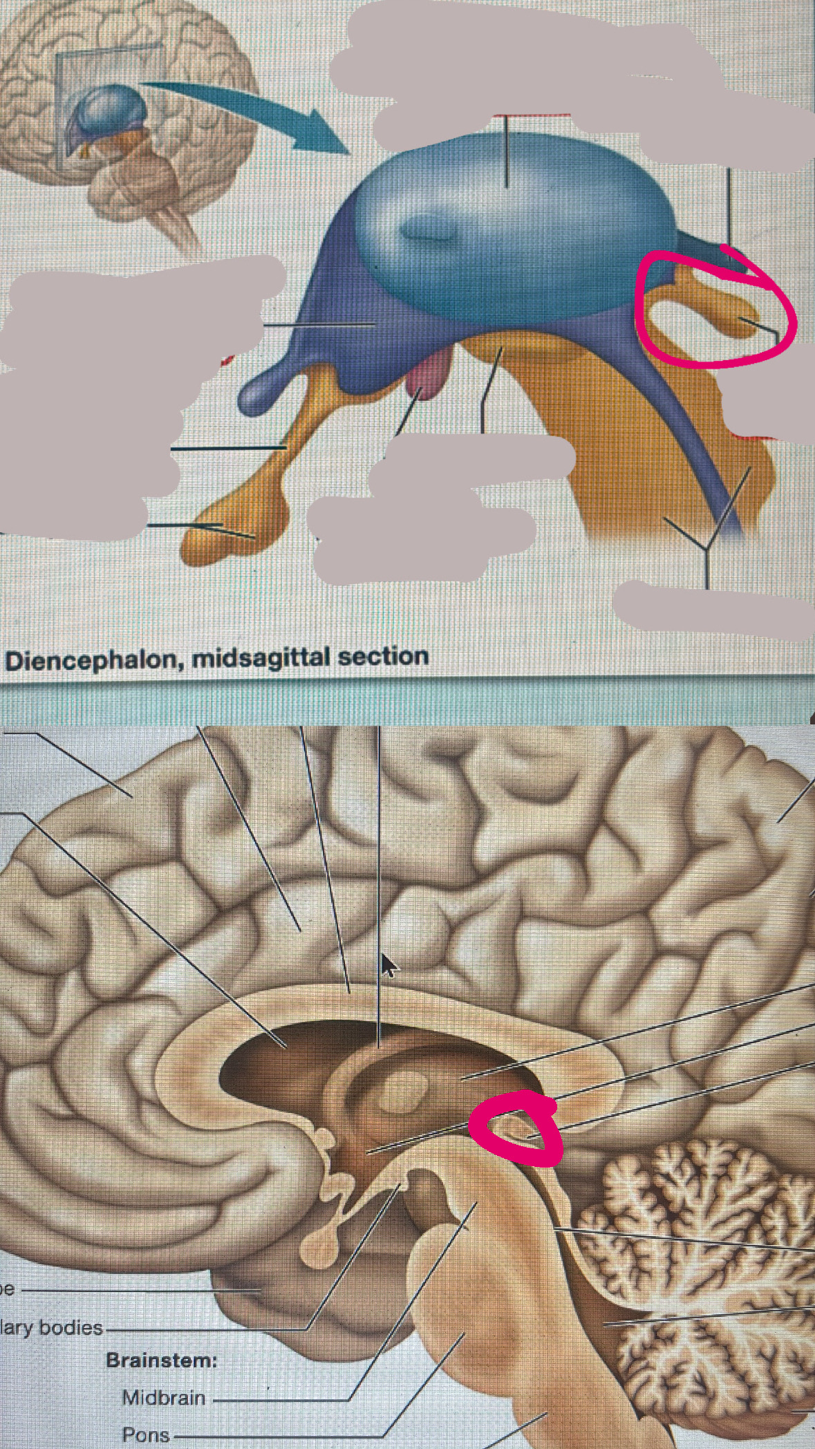 <p>is contained in the epithalamus which regulates sleep with melatonin</p>