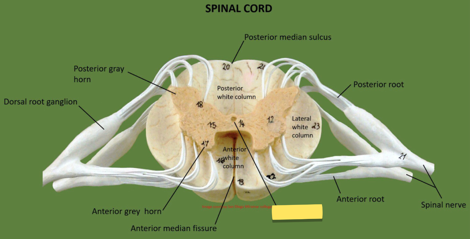 <p>Name this spinal cord part</p>