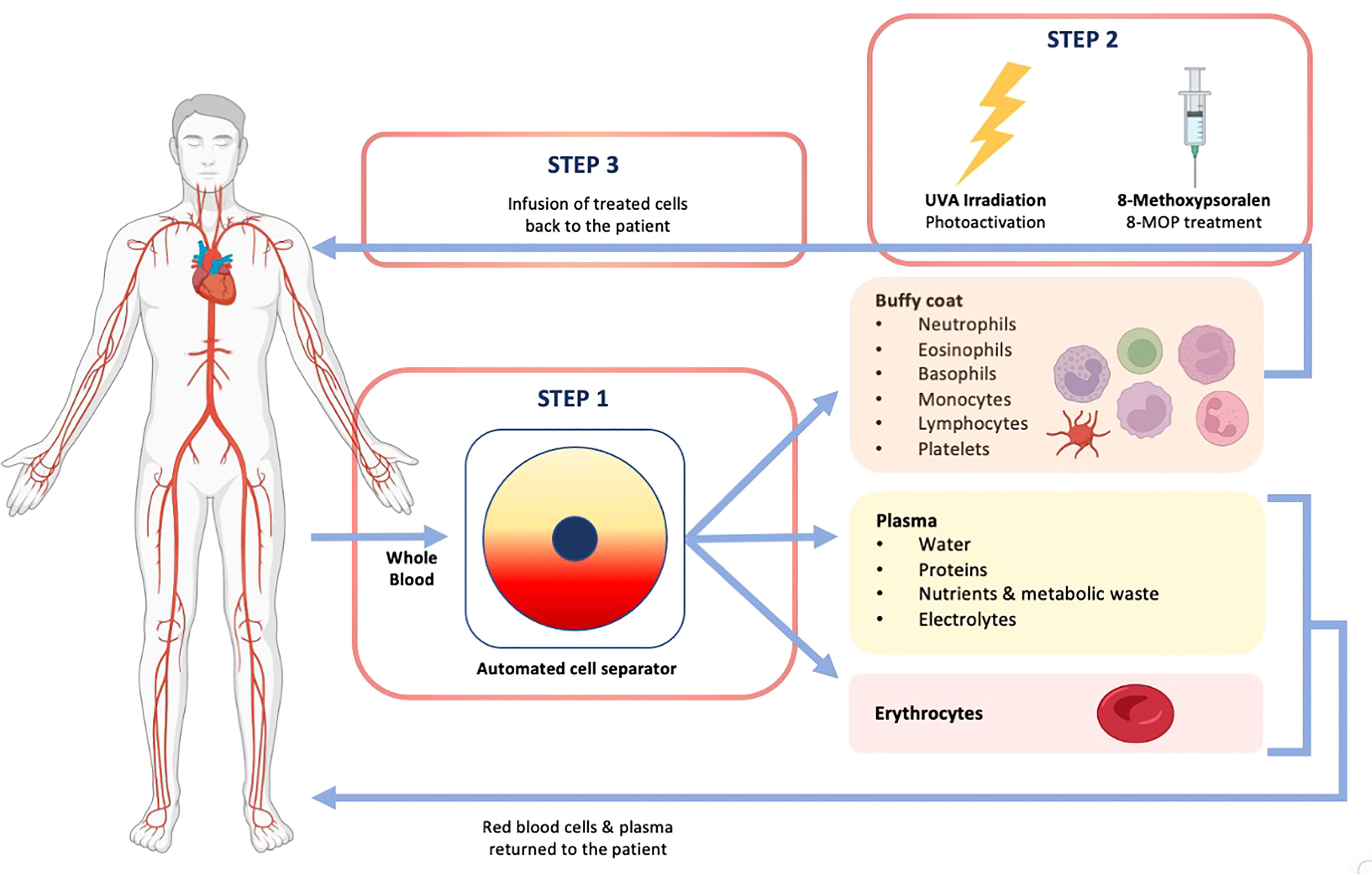 <ul><li><p>Anti-rejection drugs <strong>(corticosteroids, classical anti-rejection drugs)</strong></p></li><li><p>Monoclonal antibodies</p></li><li><p><strong>Extracorporeal photophoresis (EP)- </strong>induces tolerance without immunosuppression (UV damages DNA in lymphocytes, causes apoptosis)</p></li></ul><p></p>