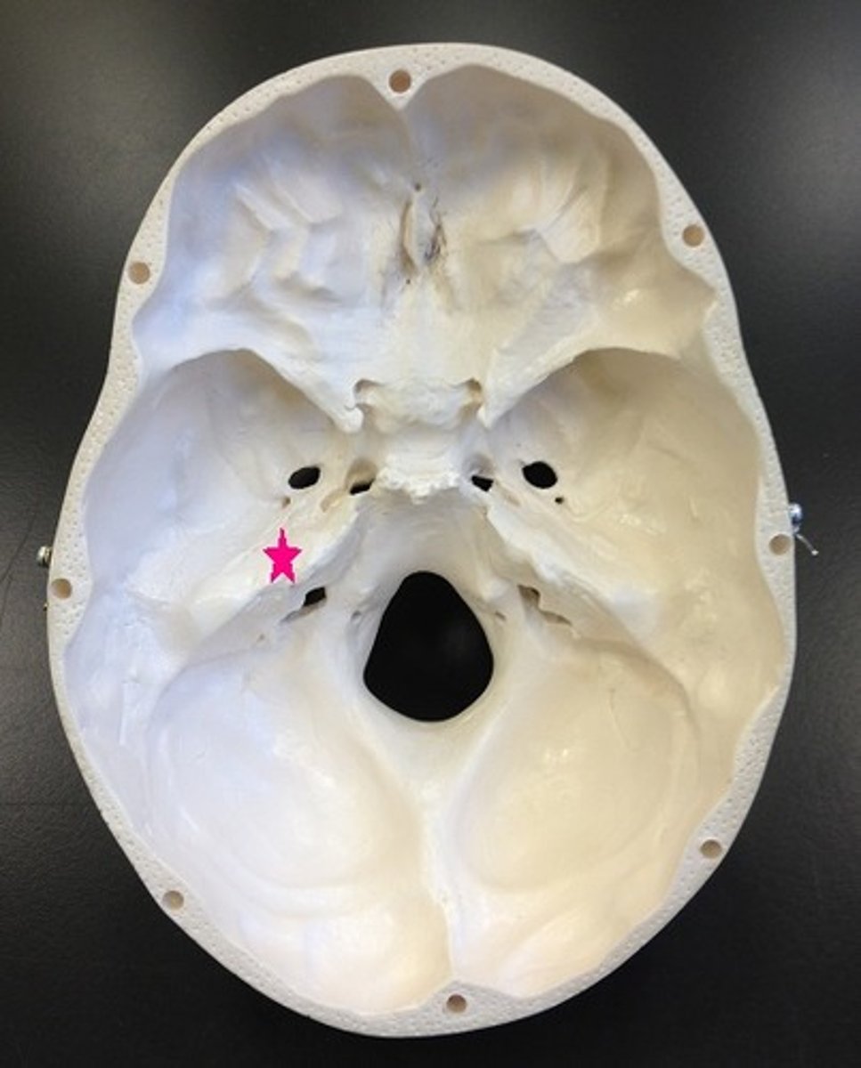 <p>Identify the bone.</p>