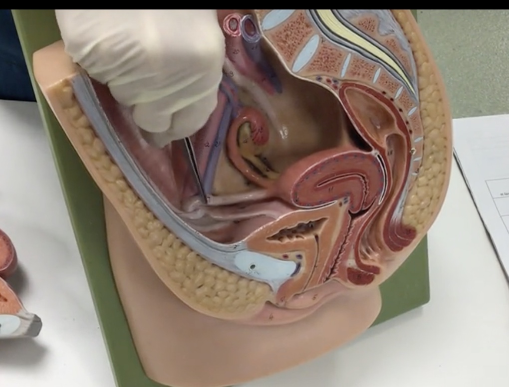 <p>Description: Fibrous cord extending from the uterus to the inguinal canal</p><p>Relationship: N/A</p>