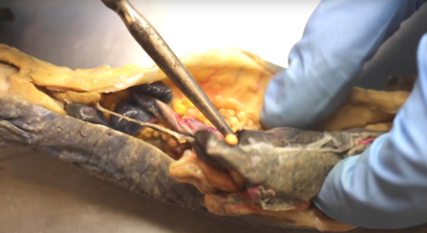 <p>liver: detox and storage</p>