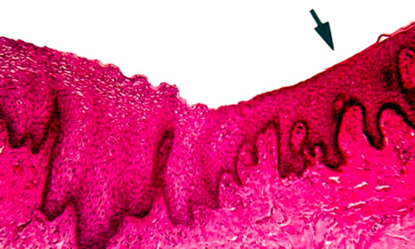 <p><em>identify the mucosa:</em></p>