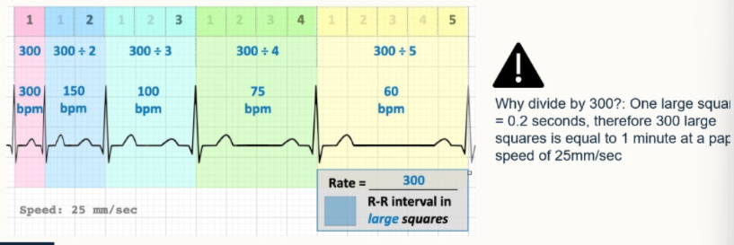 <ol><li><p>Lead II</p></li><li><p>ensure ECG is set at 25mm/sec</p></li><li><p>identify 2 consecutive R waves, count the number of large squares b/w each, divide this by 300.</p></li></ol><p></p>