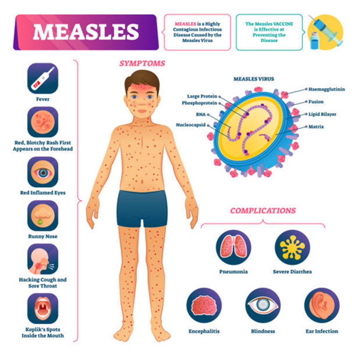 <p>Fever, runny nose, cough, conjunctivitis, photosensitivity, Koplik spots in the mouth, skin rash on the face that spreads</p>