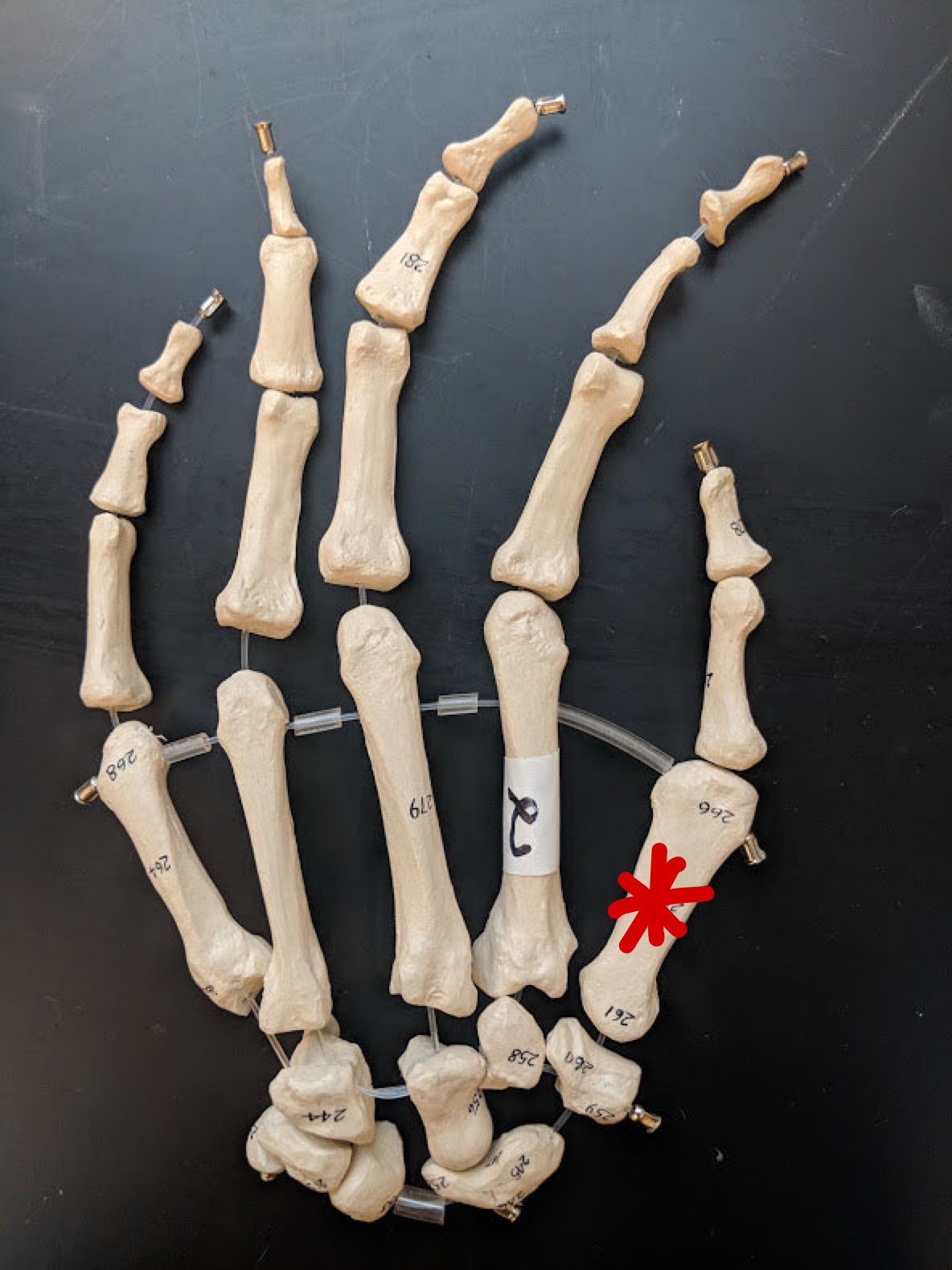 <p>Name this bone</p>