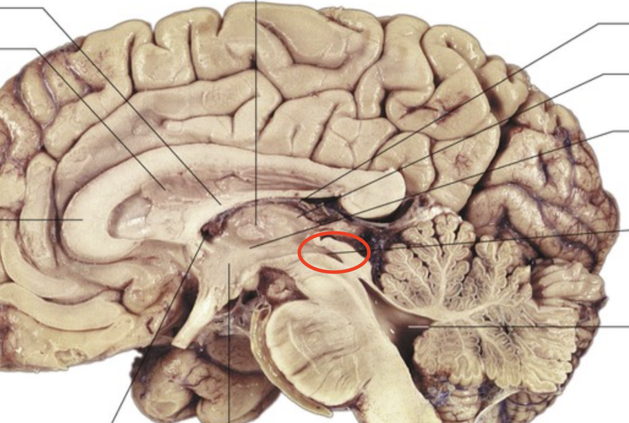 <p>Allows cerebrospinal fluid to flow between the third an fourth ventricle</p>