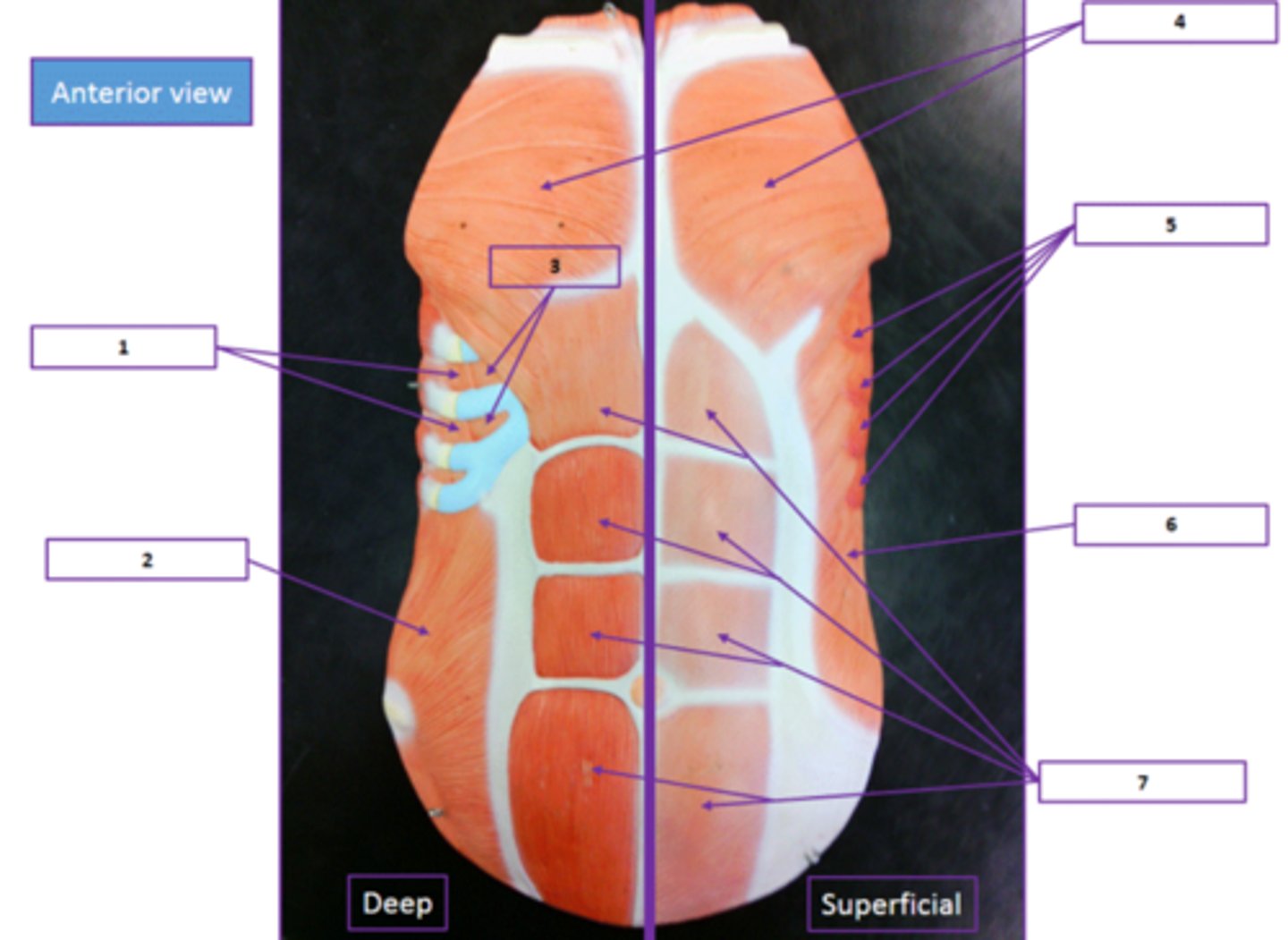 <p>Identify the muscle labeled as 5.</p>