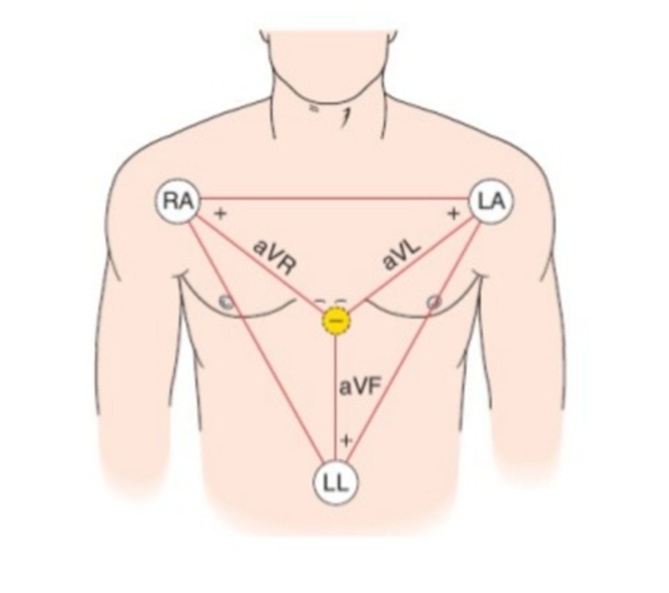 <p>(Leads I,II,III) leads composed of two opposite polarity electrodes</p>