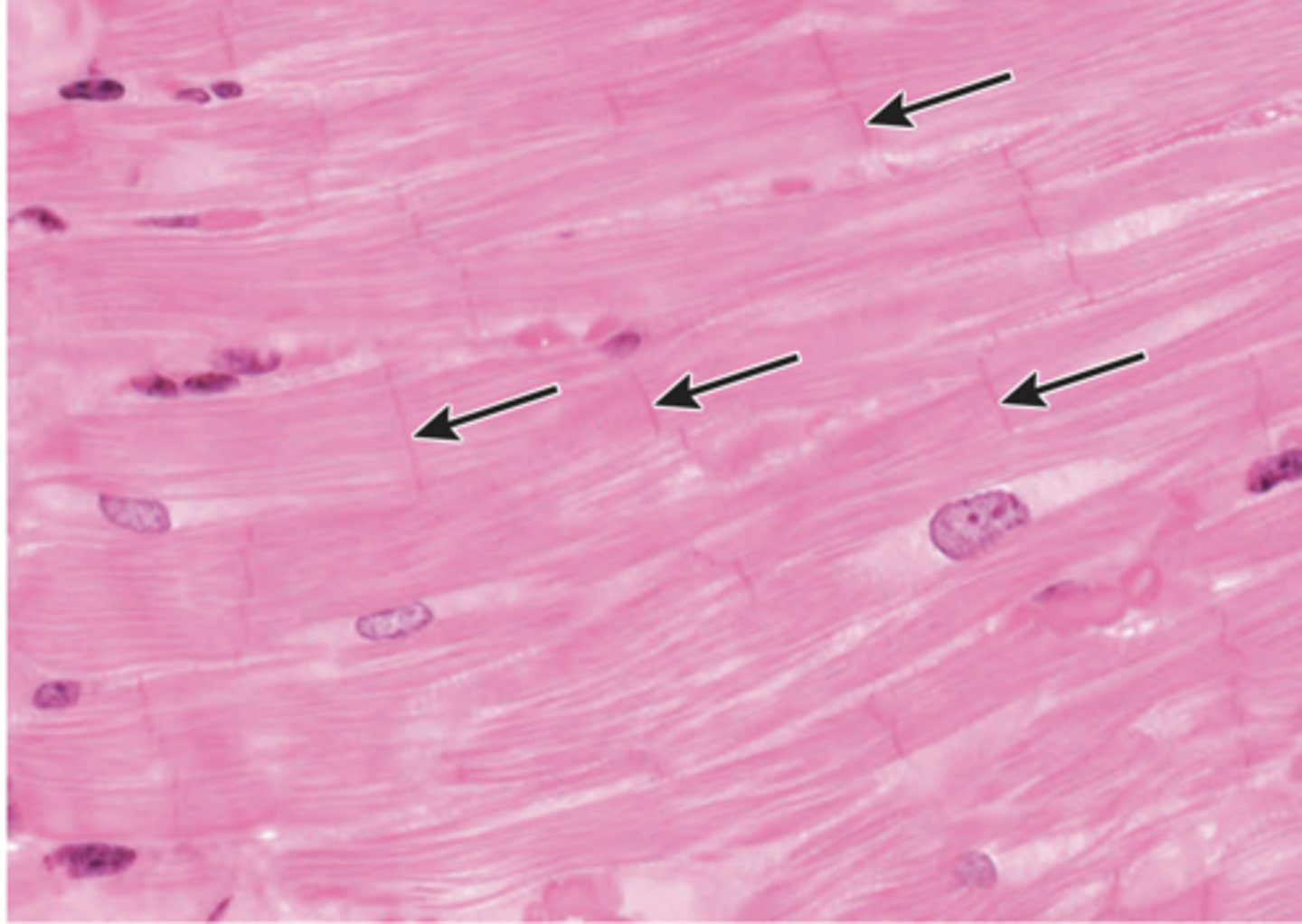 <p>Thin sections of the cardiac muscle are examined at high magnification (shown in the image). Identify the structures indicated by the arrows.</p><p>(A) A bands</p><p>(B) I bands</p><p>(C) Intercalated disks</p><p>(D) M lines</p><p>(E) Z lines</p>