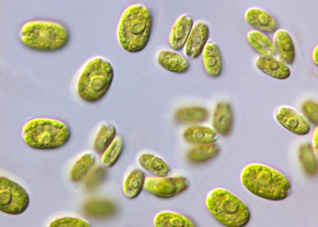 <p>Chlorophyte(has flagellar roots)</p>