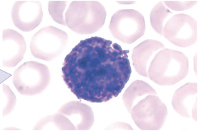 <p>granulocyte</p><ul><li><p>1-2 lobes</p></li></ul>