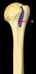 <p>What bone structure is this?</p>