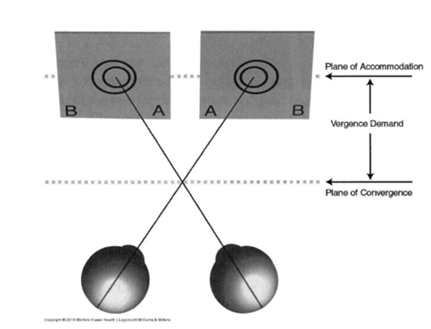 <p>converging</p><p>diverging</p>