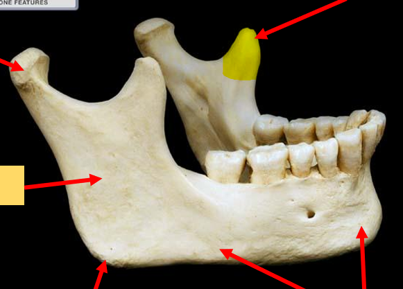 <p>What part of the bone is this?</p>