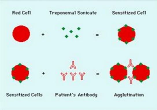 <p>Antigen attached to stained gelatin particles</p><p>Reactive = +ve in TP well and negative in control = +ve antibody</p>