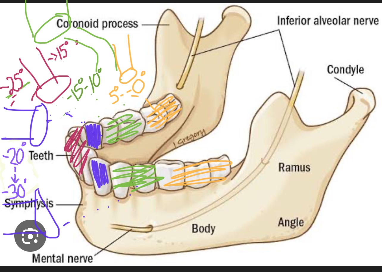<p><span>What is the correct vertical angulation for mandibular (lower) premolars when using the bisecting technique?</span></p>