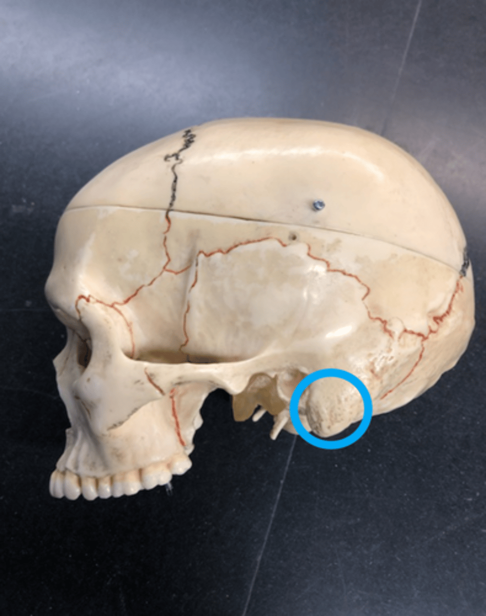 <p>Bottom part of the temporal bone closest to the occipital bone; Where the ear would be</p>