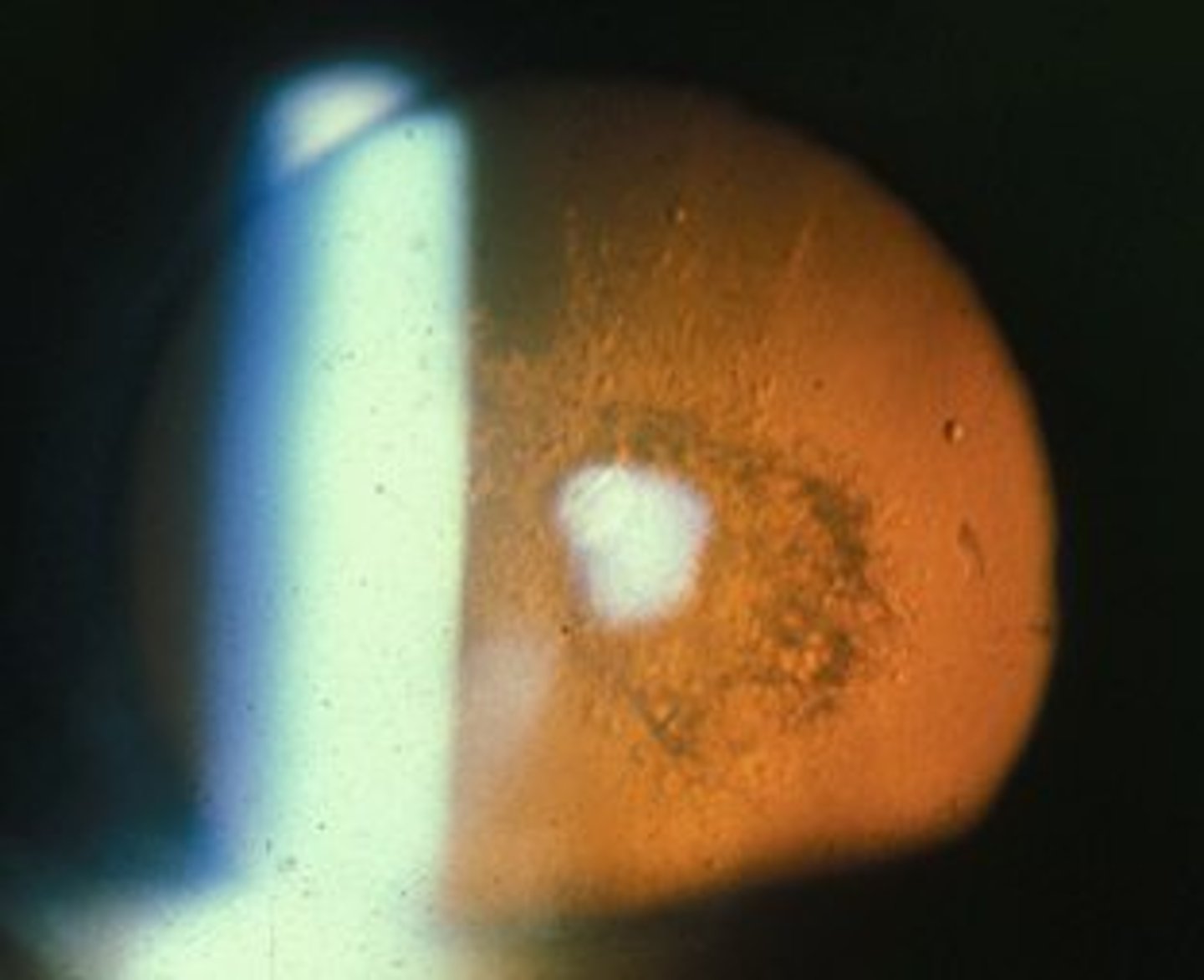 <p>On</p>