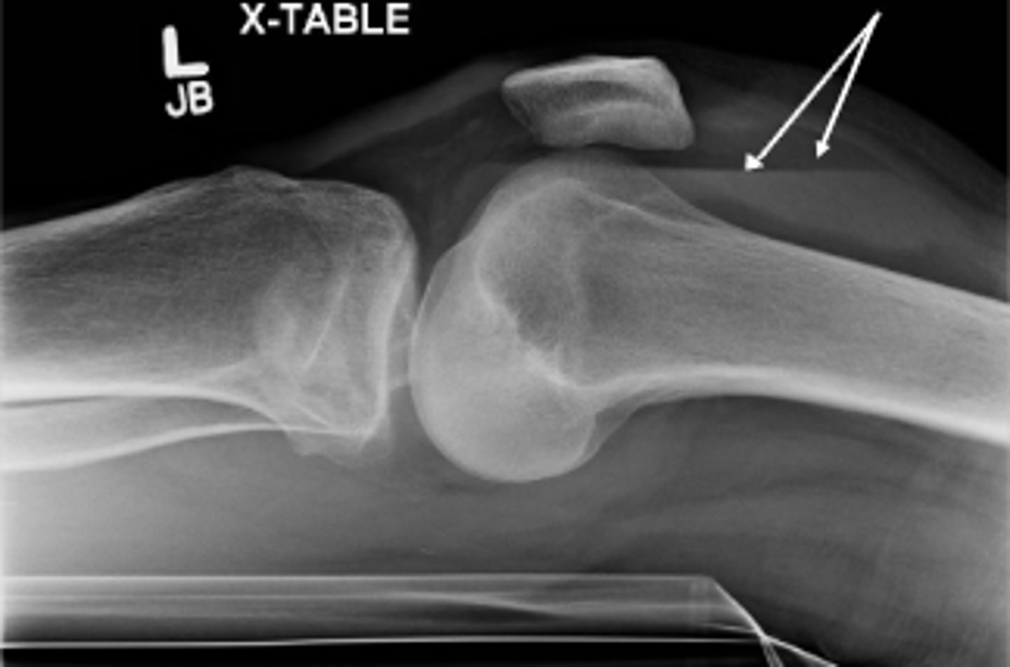 <p>What does 'x-table' mean?</p>