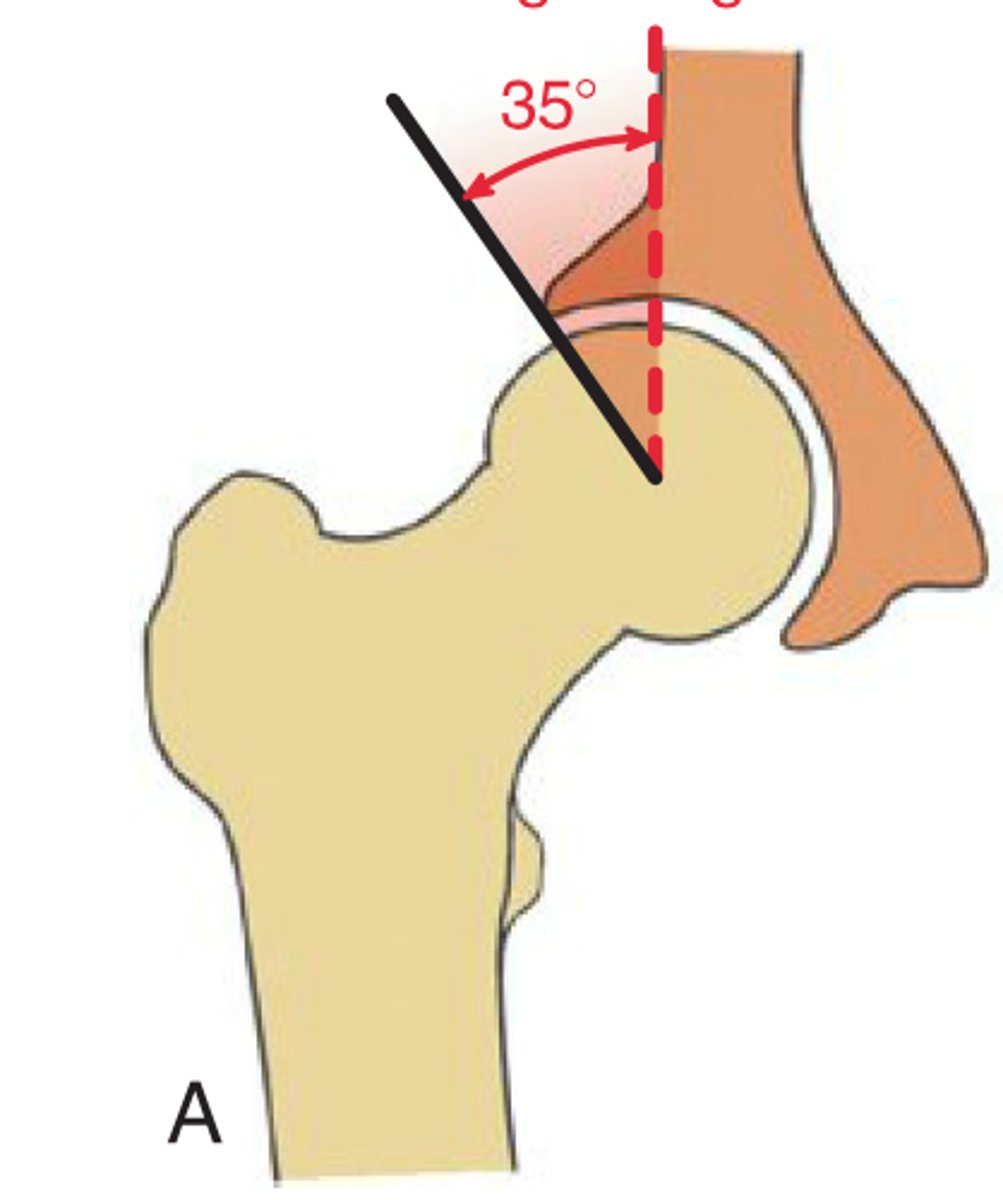 <p>1. What angle is being shown here in the frontal plane?</p>
