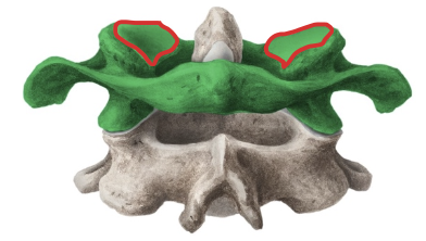 <p>Primera vértebra cervical. El lado superior tiene cavidades glenoideas (articulares) que se conectan a los cóndilos occipitales. Forma la articulación atloido-occipital o atlanto-occipital.</p>