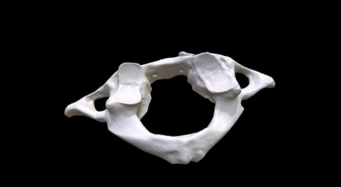 <p>What bone is this?</p>