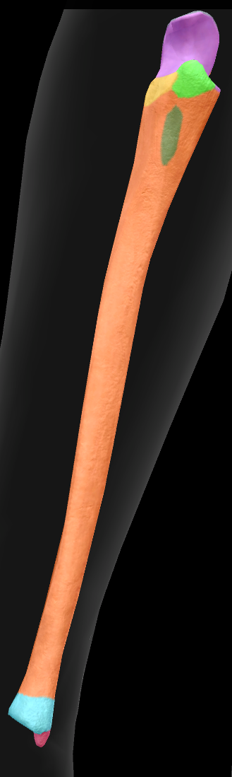 <p>Blue highlighted </p>