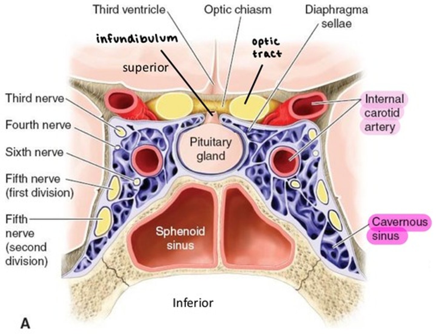 <p><strong>Internal carotid artery</strong> enters the skull via Carotid canal, then enters the Cavernous sinus.</p><p></p><p>contains oculomotor, trochlear, abducens, ophthalmic, and maxillary nerves (<strong>3, 4, 6, V1, V2</strong>).</p><p></p><p>the <strong>Ophthalmic artery</strong> is the first branch of ICA as it leaves the Cavernous sinus.</p>