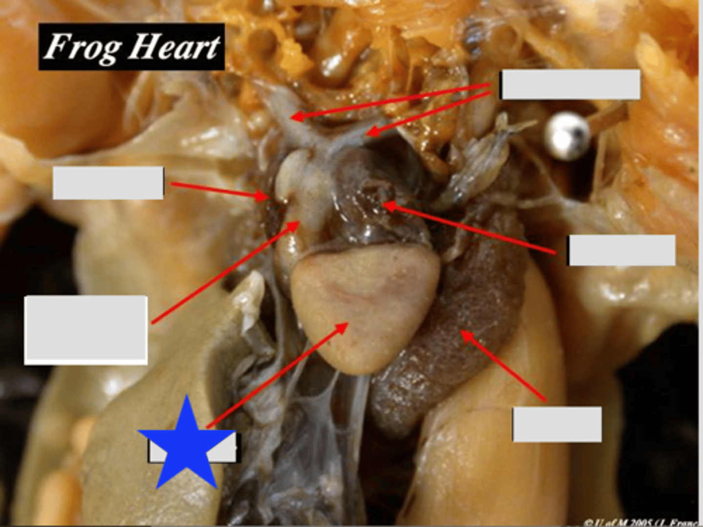 <p>Single muscular chamber pumping blood into truncus arteriosus — Large anterior chamber of three‑chambered heart</p>