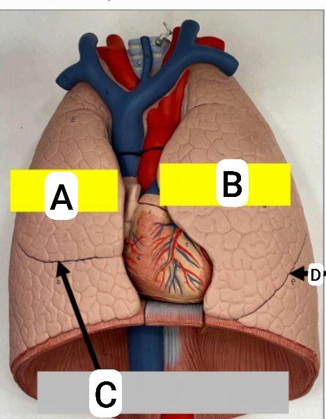 <p>Identify the following and answer these questions </p><p></p><ul><li><p>How many lobes are in each lung </p></li></ul><p></p><p>****Other questions that can’t be put as flash cards but are important****</p><p></p><p>Identification of the lung side</p><p></p><p>Naming the fissures in each lung </p><p></p><p>Naming the lobes of each lung </p><p></p>