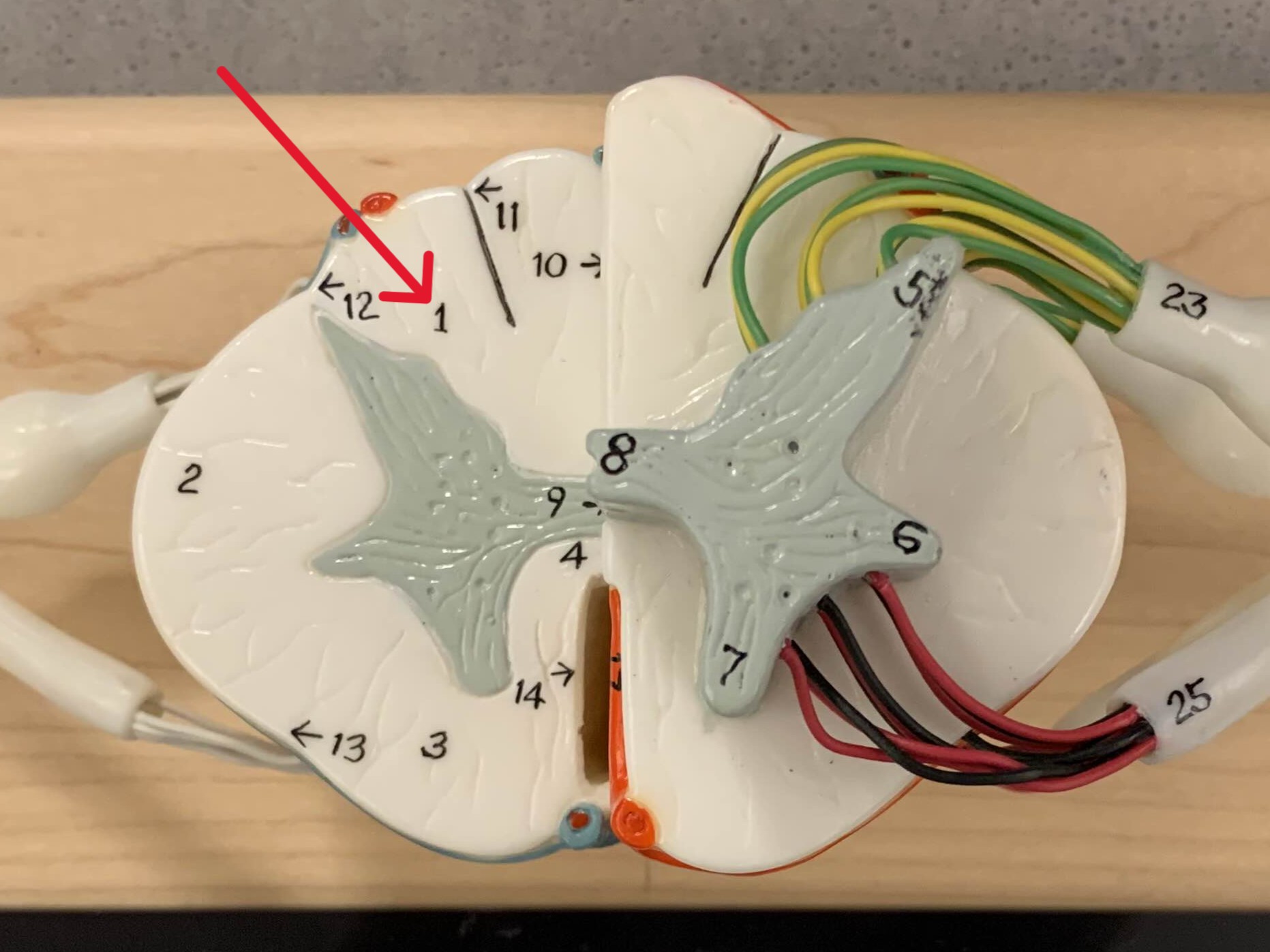 <p>Which white column of the spinal cord is:</p><ul><li><p>Between posterior gray horn and posterior median sulcus</p></li></ul><p></p>